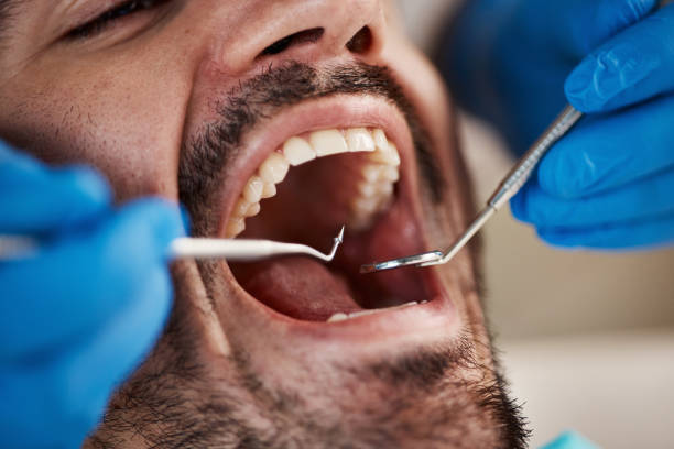 Best Emergency Broken Tooth Repair in Harlan, KY