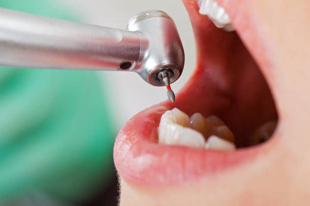 Best Walk-In Emergency Dentist in Harlan, KY